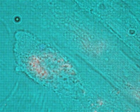 Ryc. 1 Spontaniczne wchłanianie DNA przez komórki i jądro komórek HFF1 (jasne pole połączone z czerwonym Cy-3)