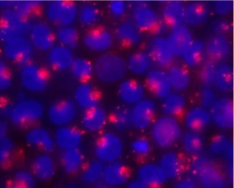 Ryc. 4 Wchłanianie DNA przez komórki NCCIT po aktywacji przez lipopolisacharyd (czerwone Cy-3 połączone z niebieskim jądrem)