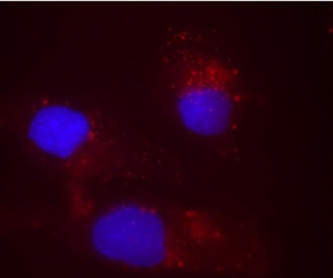Ryc. 5 Wchłanianie DNA przez komórki M059J po aktywacji przez lipopolisacharyd (10ng/104komórek). (czerwone Cy-3 połączone z niebieskim jądrem).
