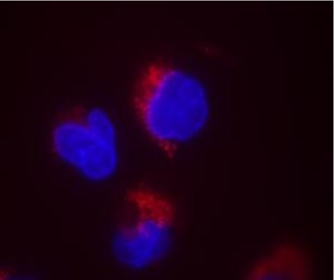 Ryc. 6 Wchłanianie DNA przez komórki M059J po aktywacji przez lipopolisacharyd (100ng/104komórek). (czerwone Cy-3 połączone z niebieskim jądrem).