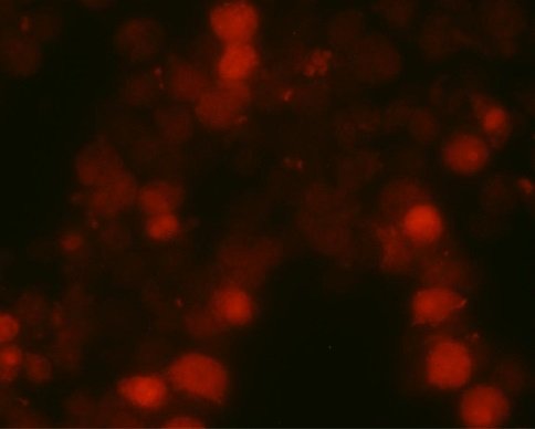 Ryc. 8 Oczyszczone jądra komórek U937 z DNA barwionym Cy-3 przed oczyszczeniem DNA (czerwone Cy-3)