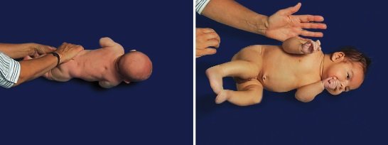 Rozwój motoryczny 2-miesięcznych niemowląt - na boku