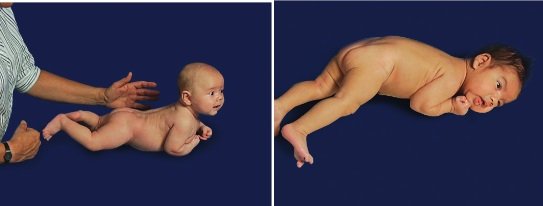 Rozwój motoryczny 2-miesięcznych niemowląt - na brzuchu