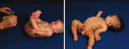 Typowy i nietypowy rozwój 4-miesięcznego dziecka - na plecach