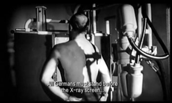 Wszyscy Niemcy musieli stanąć przed ekranem promieni rentgenowskich