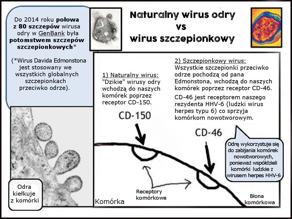 Naturalny wirus odry vs wirus szczepionkowy