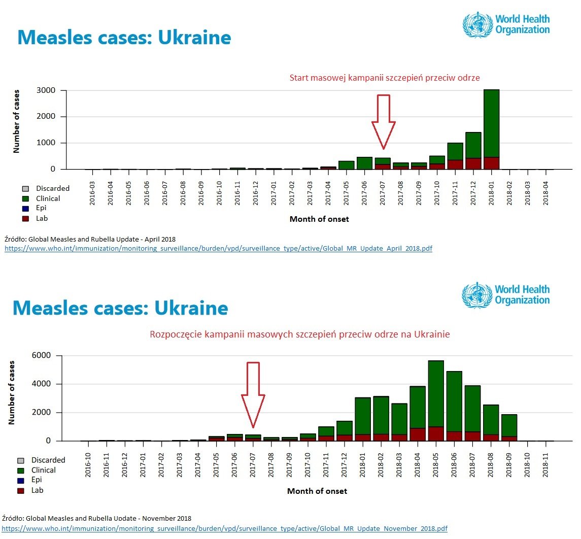 Rozpoczęcie kampanii masowych szczepień przeciw odrze na Ukrainie