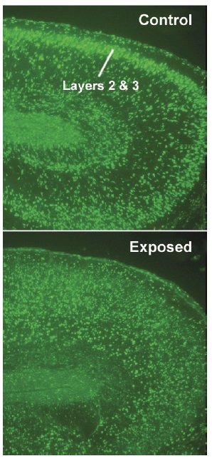 Neurony z wczesnego stadium rozwoju mózgu zostały oznaczone fluorescencyjnym zielonym barwnikiem.