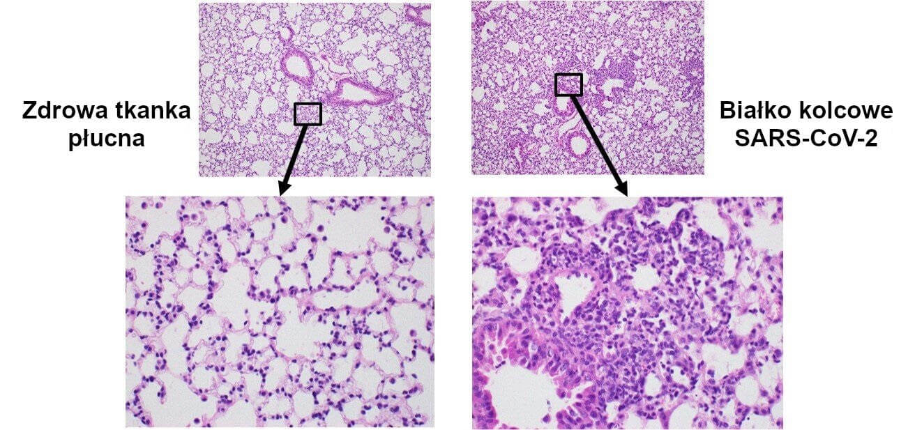 Samo białko kolcowe SARS-CoV-2 może powodować uszkodzenia płuc