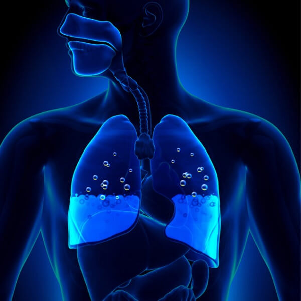 Pozaszpialne zapalenie płuc wymagające hospitalizacji